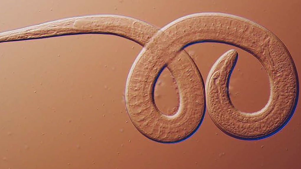 Many wildlife experts tell bear hunters to consider all bear meat infected. (CNN Newsource)