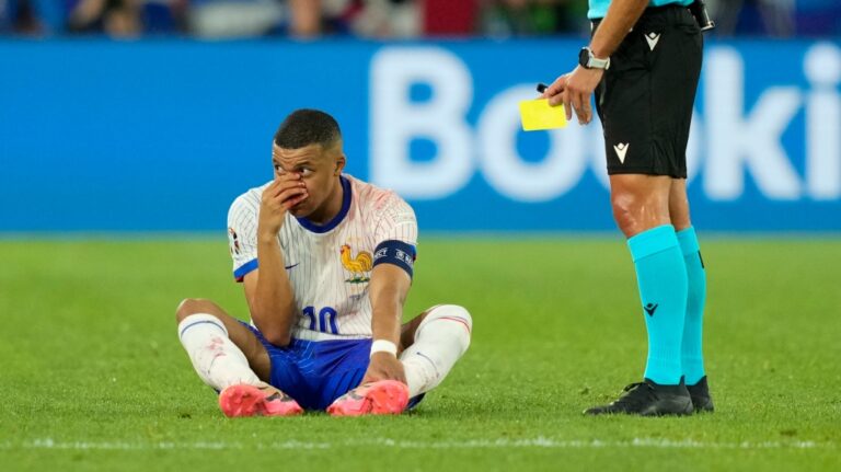 Kylian Mbappe of France holds his nose after suffering an injury during a Group D match between Austria and France at the Euro 2024 soccer tournament in Duesseldorf, Germany, Monday, June 17, 2024. (Martin Meissner / AP Photo)
