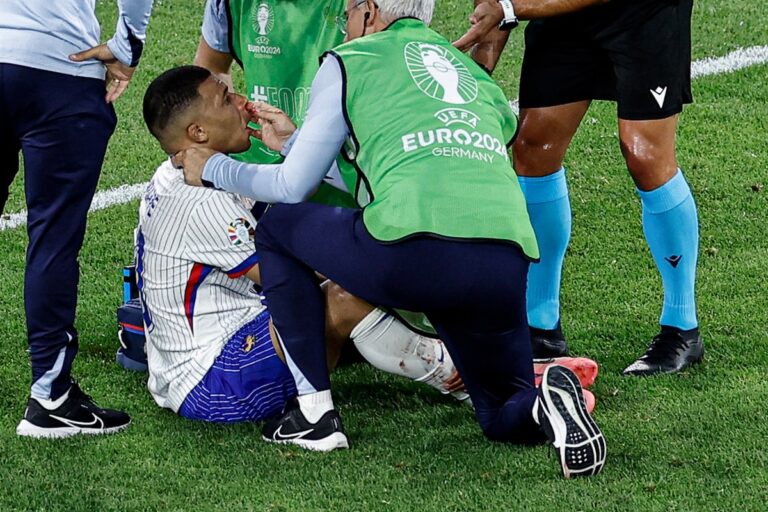 Kylian Mbappe s'est cassé le nez à l'Euro 2024, mais la France reçoit des nouvelles « positives »