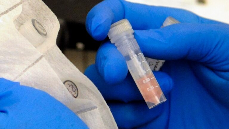 On ne s'attend pas à ce que l'essor d'une maladie bactérienne rare devienne « incontrôlable », selon un médecin