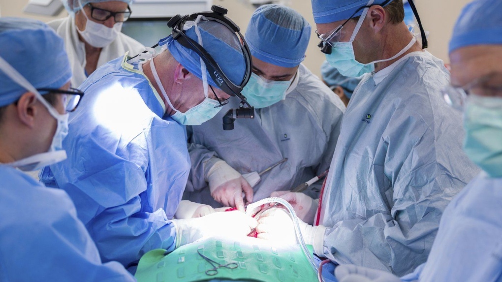 Dr. Michael Hinni, center left, Dr. Payam Entezami, center, and Dr. David Lott, center right, operate on transplant patient Marty Kedian in Phoenix, Feb. 29, 2024. (Mayo Clinic via AP)