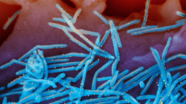 This electron microscope image shows human respiratory syncytial virus particles in blue and anti-RSV F protein/gold antibodies in yellow from the surface of human lung cells. (National Institute of Allergy and Infectious Diseases, NIH via AP)