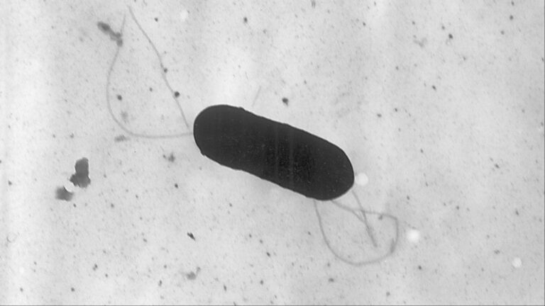 This 2002 electron microscope image made available by the Centers for Disease Control and Prevention shows a Listeria monocytogenes bacteriu. (Elizabeth White/CDC via AP, File)
