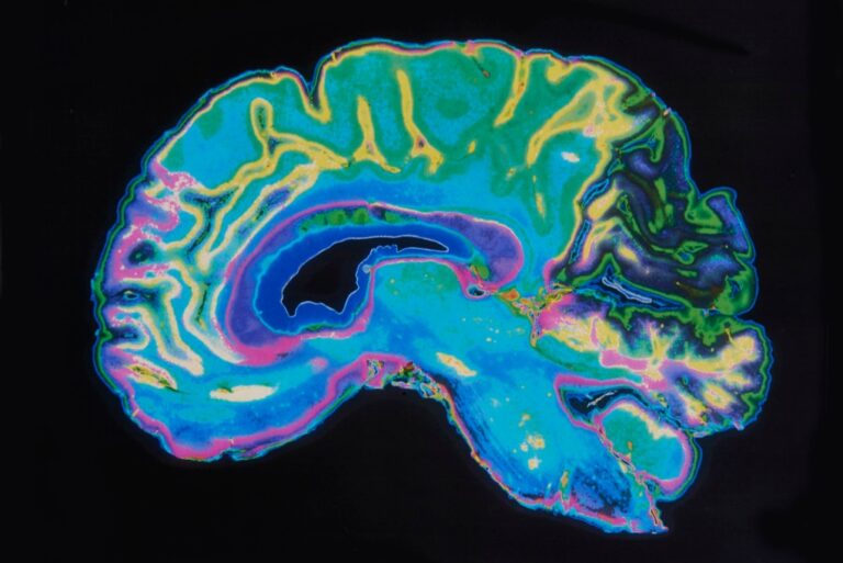 A new study of nearly 5,000 nine and 10-year-olds found that sex and gender map onto largely distinct parts of the brain. (HighwayStarz/iStockphoto/Getty Images via CNN Newsource)