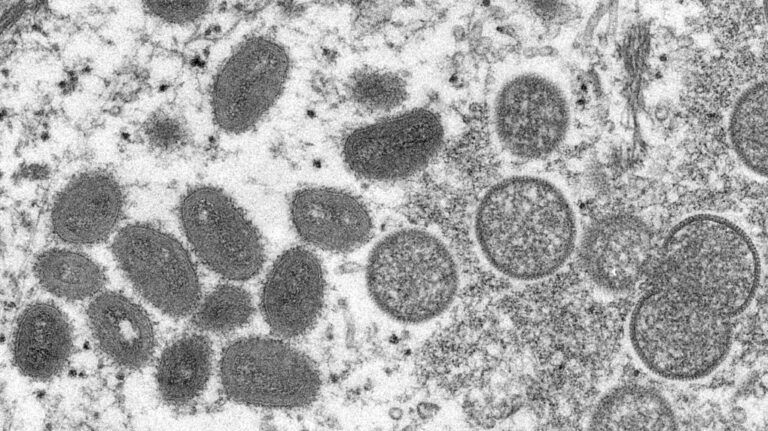 Toronto enregistre une « hausse » des cas de MPOX, selon les autorités