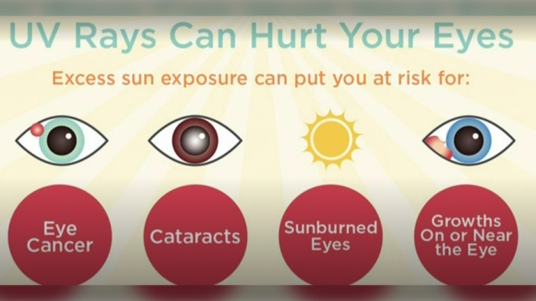 Voici pourquoi vous devriez protéger vos yeux du soleil cet été
