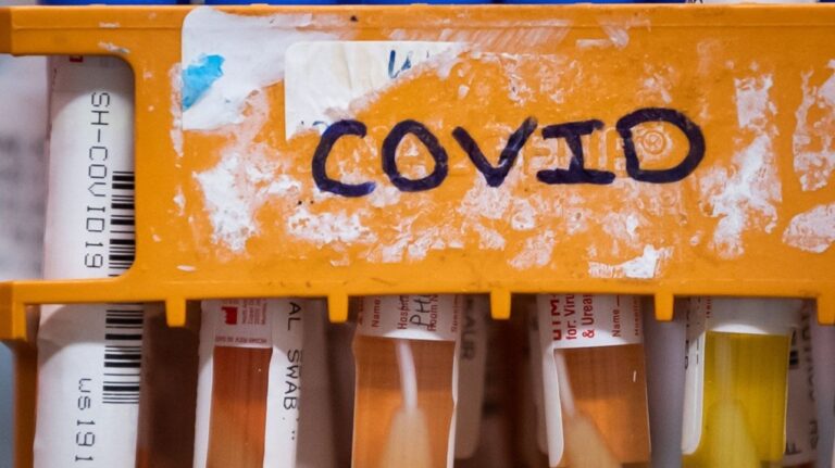 Doctors say we are in a summer wave of COVID-19. Specimens to be tested for COVID-19 are seen in Surrey, B.C., on Thursday, March 26, 2020. THE CANADIAN PRESS/Darryl Dyck