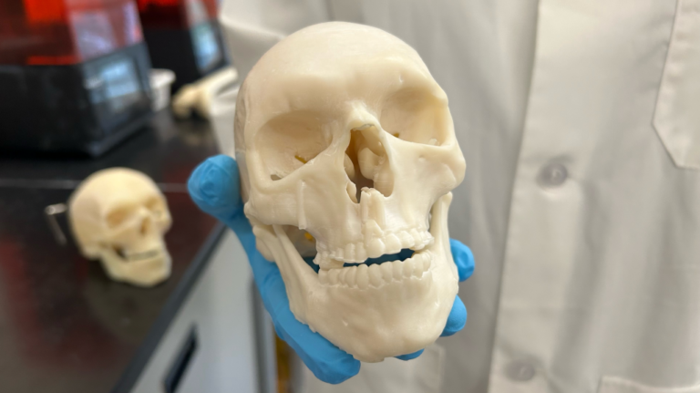 Une université de l'Ontario développe des os imprimés en 3D pour améliorer les résultats des patients atteints de cancer