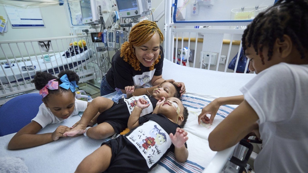 This undated photo provided by the Children’s Hospital of Philadelphia shows previously conjoined twins, Amari and Javar Ruffin, surrounded by family after separation surgery at the Children’s Hospital of Philadelphia. (Ed Cunicelli/Children’s Hospital of Philadelphia via AP)