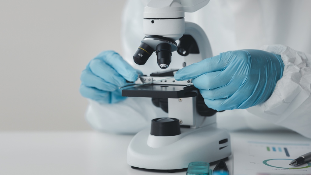 Première au Canada : des chercheurs de London, en Ontario. traiter un patient atteint de cancer avec une thérapie innovante