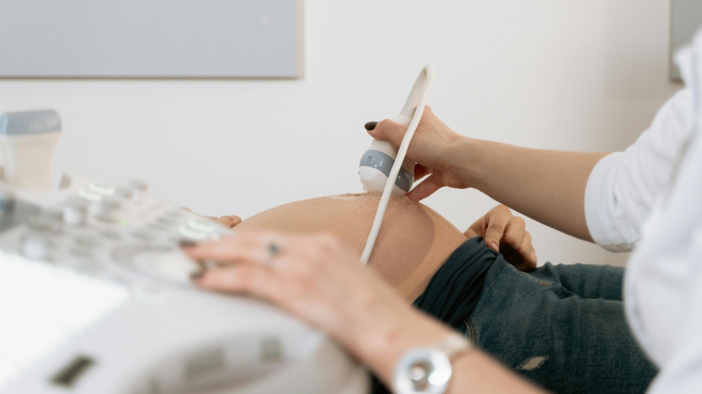 The mother, identified only be her last name Li, welcomed a boy and a girl via caesarean section. (Pexels)