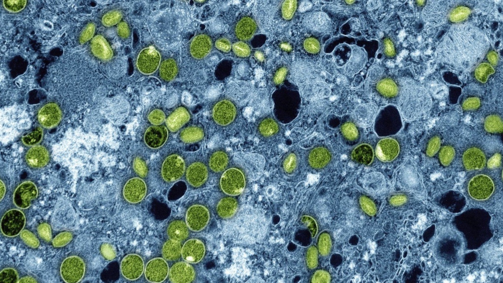 Colorized electron microscope image provided by the National Institute of Allergy and Infectious Diseases in 2024 shows Mpox virus particles.  (NIAID via AP)