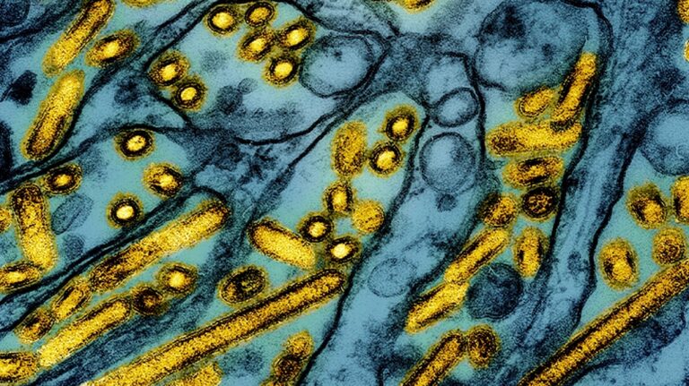 Les États-Unis confirment le premier cas de grippe aviaire chez un enfant