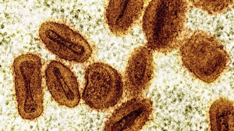 Les autorités sanitaires américaines signalent le premier cas d'une nouvelle forme de mpox chez un voyageur