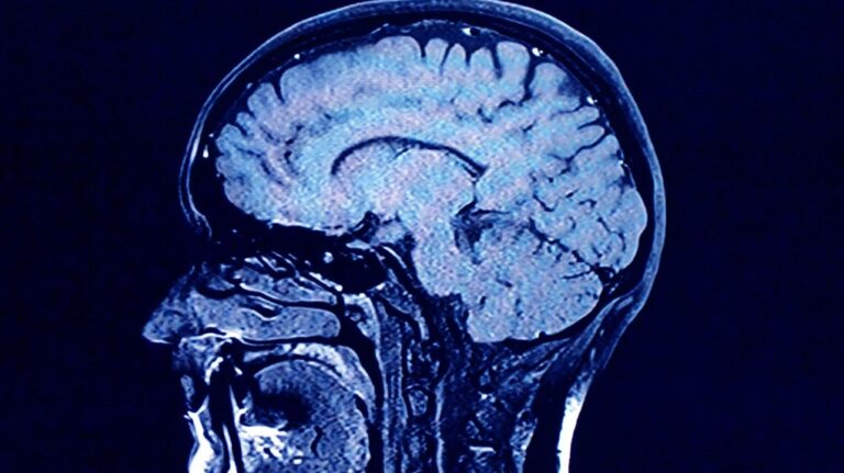 Pourquoi le vieillissement cérébral peut varier considérablement d'une personne à l'autre
