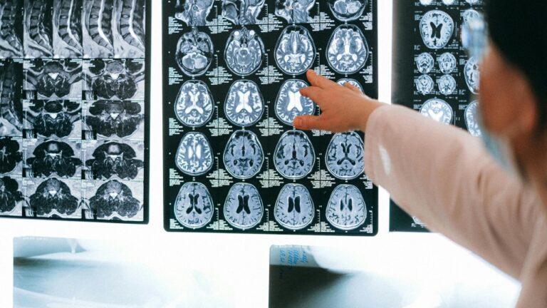 The study was published on Dec. 4 in the journal JAMA Network Open. (Pexels)
