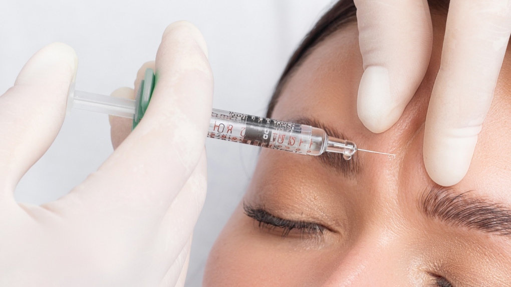 Une infirmière de Colombie-Britannique suspendue pour utilisation inappropriée du Botox, selon un collège