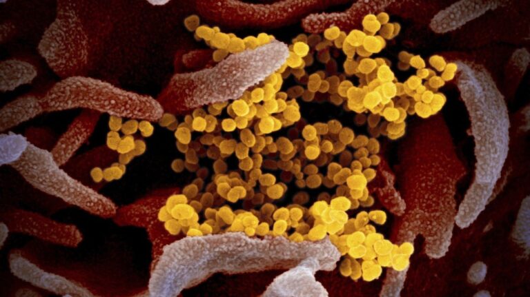 This undated electron microscope image made available by the U.S. National Institutes of Health in February 2020 shows the Novel Coronavirus SARS-CoV-2, yellow, emerging from the surface of cells, pink, cultured in the lab. Also known as 2019-nCoV, the virus causes COVID-19.(NIAID-RML via AP, File)
