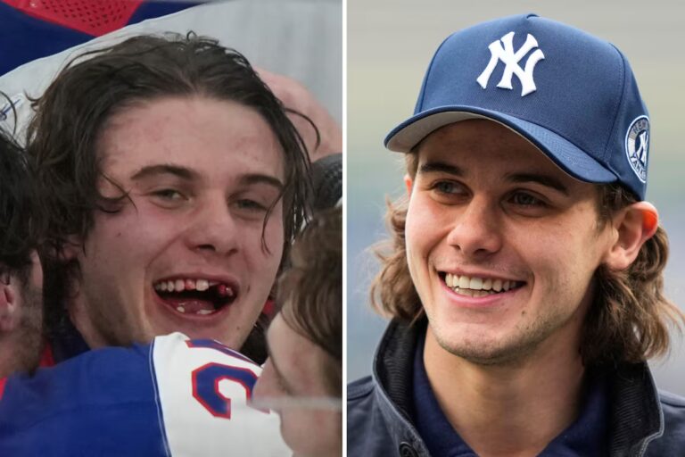 Le héros olympique du hockey Jack Hughes a de nouveaux chiclets alors que les dentistes de la LNH sont sous les projecteurs