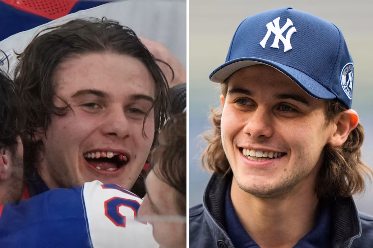 Le héros olympique du hockey Jack Hughes a de nouveaux chiclets alors que les dentistes de la LNH sont sous les projecteurs