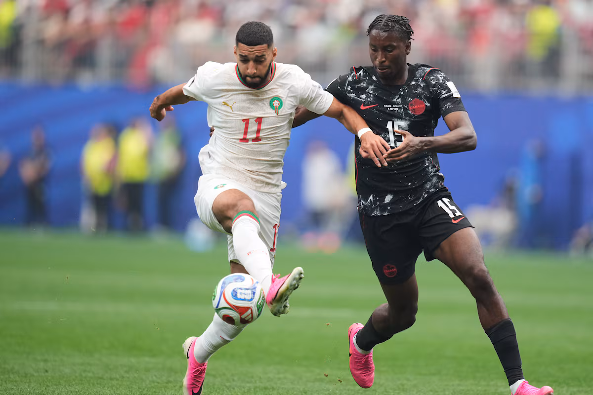 Bombito s'apprête à subir une deuxième opération au tibia gauche après avoir « lutté » pendant la Coupe du monde